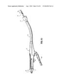 Ratcheting Mechanism for Surgical Stapling Device diagram and image