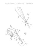 METHOD OF SENSING GASES DURING MEDICAL PROCEDURES diagram and image