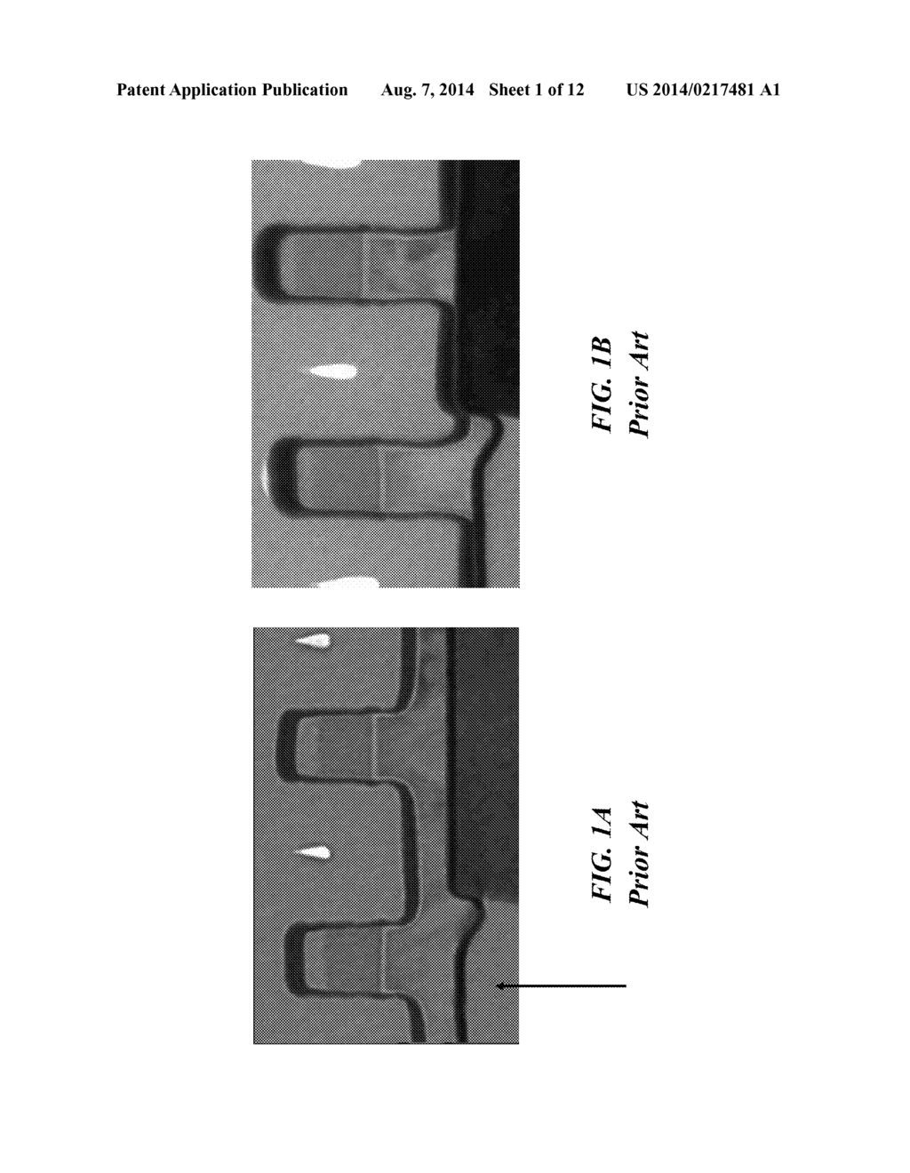 PARTIAL SACRIFICIAL DUMMY GATE WITH CMOS DEVICE WITH HIGH-K METAL GATE - diagram, schematic, and image 02