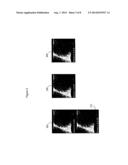 System for Frame Selection for Optimal Registration of a Multi-frame     Dataset diagram and image