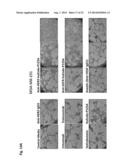 ANTIBODY- ENDOSTATIN FUSION PROTEIN AND ITS VARIANTS diagram and image