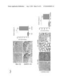 Administration of an Anti-Activin-A Compound to a Subject diagram and image