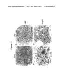 MICRORNA INHIBITION FOR THE TREATMENT OF INFLAMMATION AND     MYELOPROLIFERATIVE DISORDERS diagram and image