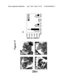 MICRORNA INHIBITION FOR THE TREATMENT OF INFLAMMATION AND     MYELOPROLIFERATIVE DISORDERS diagram and image