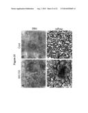 MICRORNA INHIBITION FOR THE TREATMENT OF INFLAMMATION AND     MYELOPROLIFERATIVE DISORDERS diagram and image