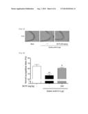 PHARMACEUTICAL COMPOSITION CONTAINING EXTRACT OF HOUTTUYNIA CORDATA AS     ACTIVE INGREDIENT FOR PREVENTING AND TREATING DEMENTIA, PARKINSON S     DISEASE, OR EPILEPSY diagram and image