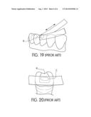 DENTAL SHAPING STRIP diagram and image