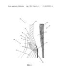 PERIODONTAL TREATMENT SYSTEM AND METHOD diagram and image