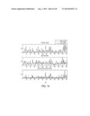 Video-Based System for Improving Surgical Training by Providing Corrective     Feedback on a Trainee s Movement diagram and image