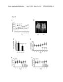 METHOD FOR SCREENING AN AGENT PREVENTING OR TREATING CANCER USING     GLYCYL-TRNA SYNTHETASE AND CADHERIN diagram and image