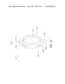 COAXIAL CABLE CONNECTOR HAVING ELECTRICAL CONTINUITY MEMBER diagram and image