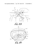 SOOTHING DEVICE WITH REMOVABLY ATTACHED TOY diagram and image