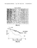 Method of Diagnosis or Prognosis of a Neoplasm Comprising Determining the     Level of Expression of a Protein in Stromal Cells Adjacent to the     Neoplasm diagram and image