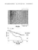 Method of Diagnosis or Prognosis of a Neoplasm Comprising Determining the     Level of Expression of a Protein in Stromal Cells Adjacent to the     Neoplasm diagram and image