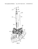 Apparatus and Method for Enlarging an Incision diagram and image