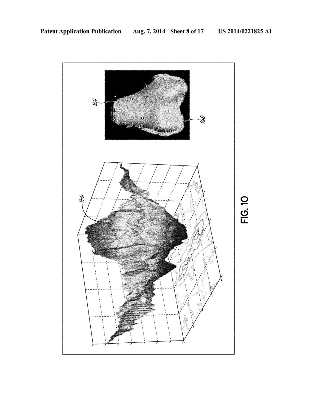 Real-Time 3-D Ultrasound Reconstruction of Knee and Its Implications For     Patient Specific Implants and 3-D Joint Injections - diagram, schematic, and image 09