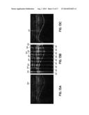 Real-Time 3-D Ultrasound Reconstruction of Knee and Its Implications For     Patient Specific Implants and 3-D Joint Injections diagram and image