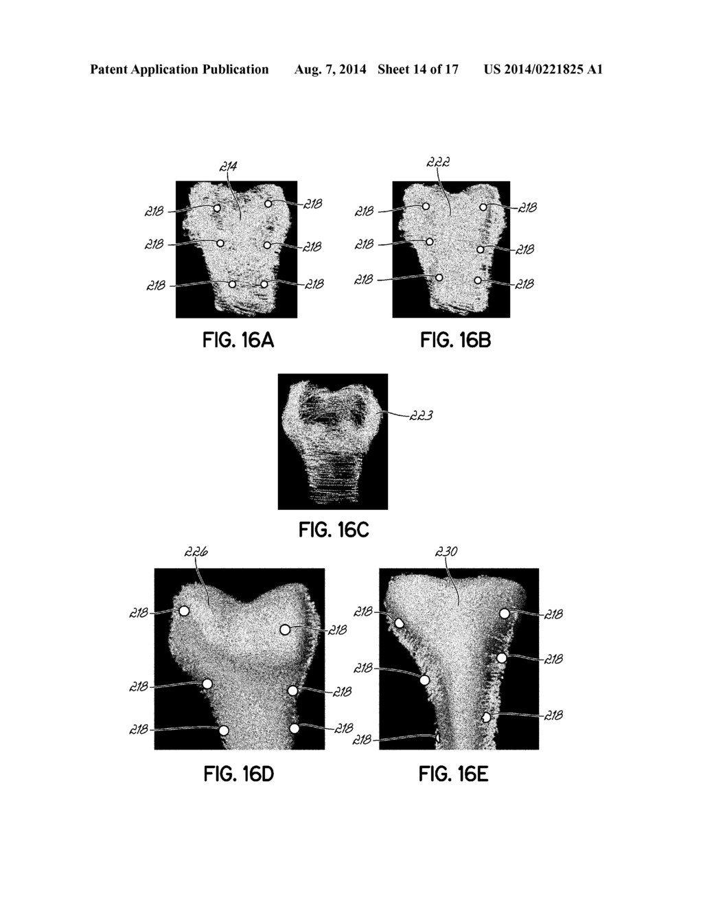 Real-Time 3-D Ultrasound Reconstruction of Knee and Its Implications For     Patient Specific Implants and 3-D Joint Injections - diagram, schematic, and image 15