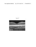 ENHANCED OPTICAL ANGIOGRAPHY USING INTENSITY CONTRAST AND PHASE CONTRAST     IMAGING METHODS diagram and image