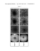 ENHANCED OPTICAL ANGIOGRAPHY USING INTENSITY CONTRAST AND PHASE CONTRAST     IMAGING METHODS diagram and image