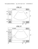 ULTRASOUND DIAGNOSTIC IMAGING APPARATUS diagram and image