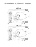 ULTRASOUND DIAGNOSTIC IMAGING APPARATUS diagram and image