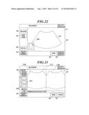 ULTRASOUND DIAGNOSTIC IMAGING APPARATUS diagram and image