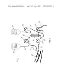 System and Method for Delivery of Regional Citrate Anticoagulation to     Extracorporeal Blood Circuits diagram and image