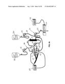 System and Method for Delivery of Regional Citrate Anticoagulation to     Extracorporeal Blood Circuits diagram and image