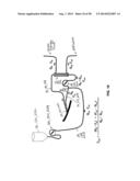 System and Method for Delivery of Regional Citrate Anticoagulation to     Extracorporeal Blood Circuits diagram and image