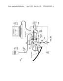 System and Method for Delivery of Regional Citrate Anticoagulation to     Extracorporeal Blood Circuits diagram and image