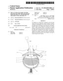 IMPLANT FOR LIVING BODY, METHOD FOR ADJUSTING DRUG RELEASE DENSITY FROM     THE IMPLANT, AND METHOD FOR TREATMENT USING THE IMPLANT diagram and image