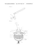 IMPLANT FOR LIVING BODY, METHOD FOR ADJUSTING DRUG RELEASE DENSITY FROM     THE IMPLANT, AND METHOD FOR TREATMENT USING THE IMPLANT diagram and image