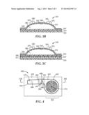 POSITIVE PRESSURE MEDICAL DRESSINGS WITH VALVE AND KITS CONTAINING SAME diagram and image