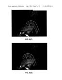 SURFACTANT PORTED DEVICE FOR TREATMENT OF BLEPHARITIS AND APPLICATIONS OF     SAME diagram and image