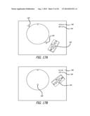 ENDOSCOPE STRUCTURES AND TECHNIQUES FOR NAVIGATING TO A TARGET IN A     BRANCHED STRUCTURE diagram and image