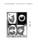 ENDOSCOPE STRUCTURES AND TECHNIQUES FOR NAVIGATING TO A TARGET IN A     BRANCHED STRUCTURE diagram and image