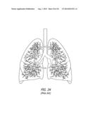 ENDOSCOPE STRUCTURES AND TECHNIQUES FOR NAVIGATING TO A TARGET IN A     BRANCHED STRUCTURE diagram and image