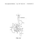 DEVICE, SYSTEM AND METHODS FOR THE ORAL DELIVERY OF THERAPEUTIC COMPOUNDS diagram and image