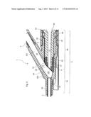 CATHETER INTRODUCER ASSEMBLY diagram and image