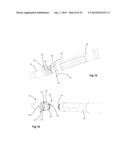 Medical Needle Assembly diagram and image