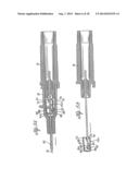 SPRING CLIP SAFETY IV CATHETER diagram and image