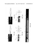 NEEDLE FOR DELIVERY OF DERMAL FILLER THREADS diagram and image