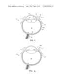 DIAGNOSTIC METHODS AND APPARATUS diagram and image