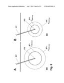 Infusion Arrangement and Method diagram and image