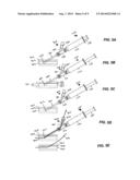 DEVICES AND METHODS FOR IMPROVED VASCULAR ACCESS diagram and image