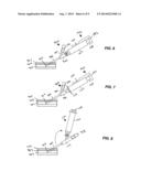 DEVICES AND METHODS FOR IMPROVED VASCULAR ACCESS diagram and image