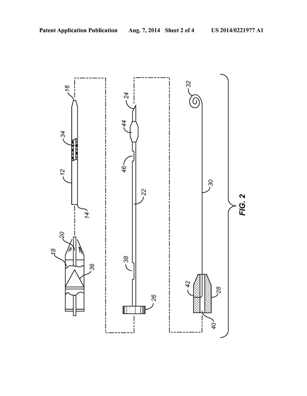 SYSTEMS AND METHODS FOR NEEDLE AND CATHETER ADVANCEMENT - diagram, schematic, and image 03