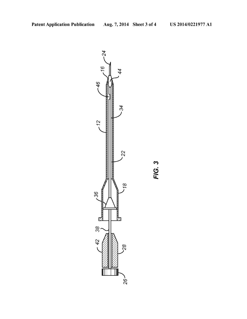 SYSTEMS AND METHODS FOR NEEDLE AND CATHETER ADVANCEMENT - diagram, schematic, and image 04