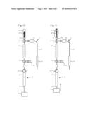 Balloon Catheter Systems for Delivery of Dry Drug Delivery Vesicles to a     Vessel in the Body diagram and image